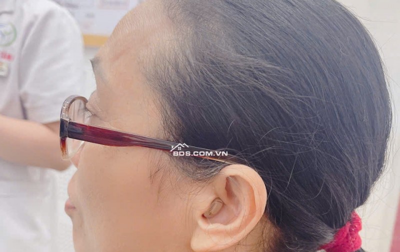 Máy trợ thính thẩm mỹ bí mật sâu trong ống tai đeo như không đeo